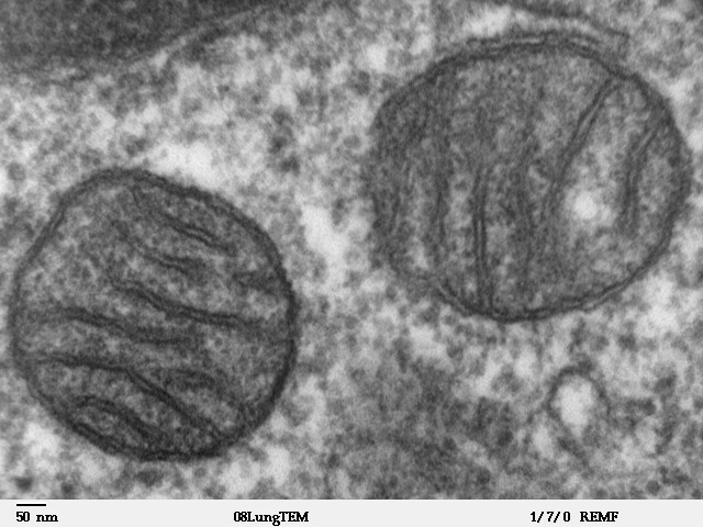Электронная микрофотография митохондрии с многочисленными складками внутренней мембраны
